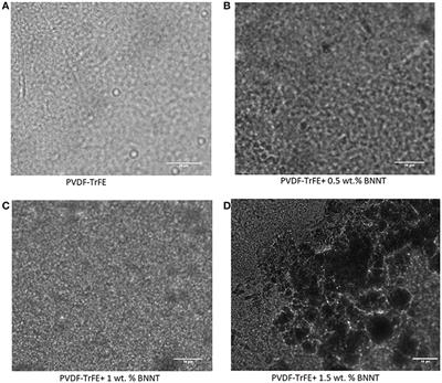 Boron Nitride Nanotube Addition Enhances the Crystallinity and Cytocompatibility of PVDF-TrFE